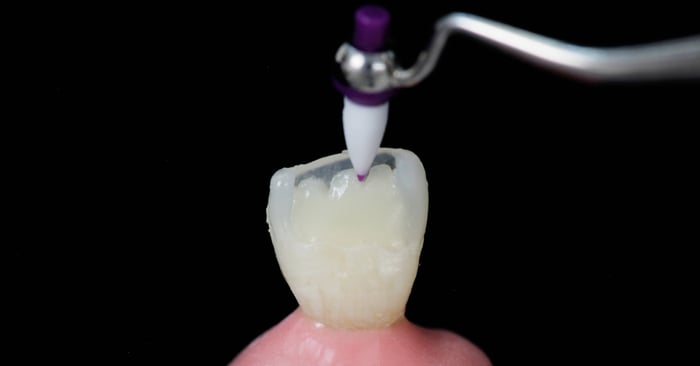 Consiglio pratico: ecco come modellare i mammelloni nei denti anteriori