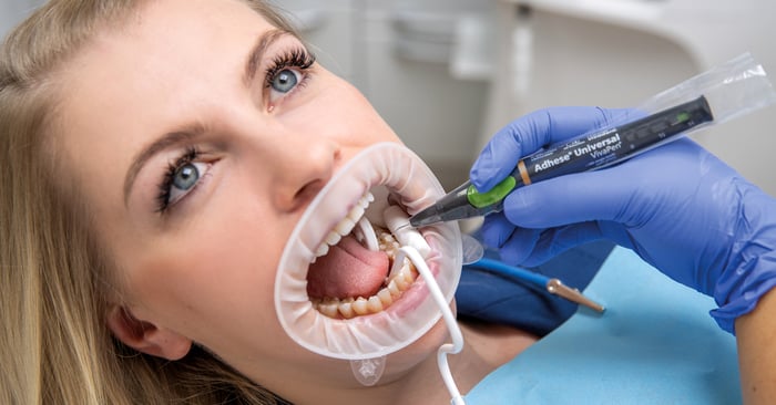 The Art of Efficient Esthetics - Next Generation Composites