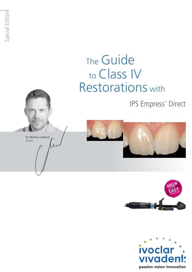 The Guide to Class IV Restorations with IPS Empress Direct
