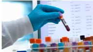 Medical Test