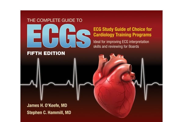 The Complete Guide to ECGs