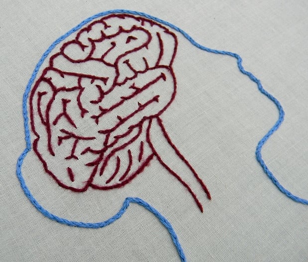 migraineurs often find moving makes them physically sick, gives