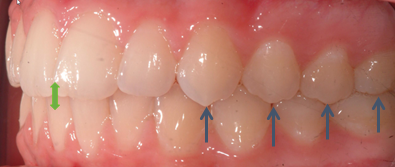 Related image