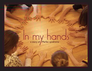 Film Screening In My Hands A Story Of Marfan Syndrome The Marfan Foundation Film Screening In My Hands A Story Of Marfan Syndrome The Marfan Foundation