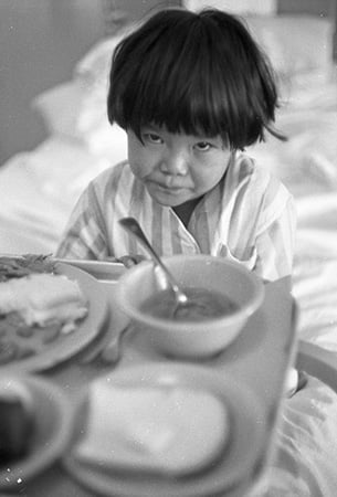 young tuberculosis patient