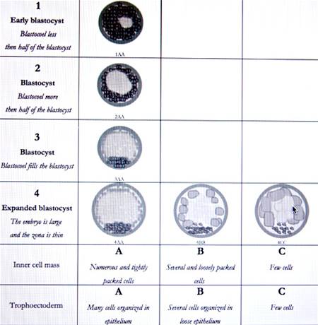 Embryo Quality Chart