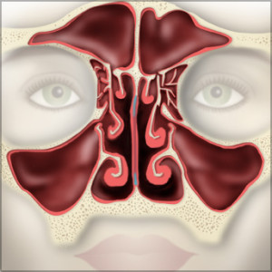 Sinus Problems: 4 Effects on Facial Aesthetics