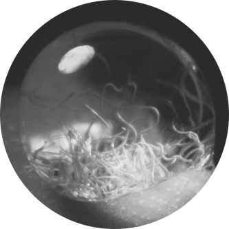 Lungworm-in-dewdrop