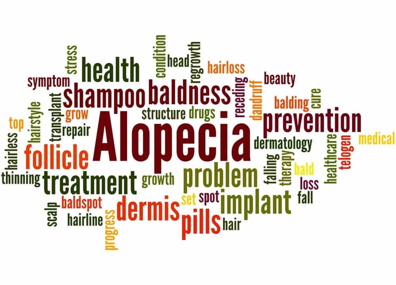 What is Alopecia Areata (Hair Loss)? Definition, Symptoms and Causes