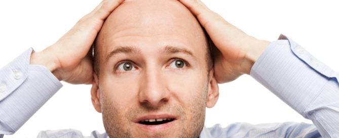 Things to Consider About Hair Transplants
