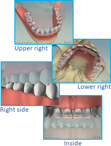 Ideal-Tooth-Contacts-4-Views-In-Sequence
