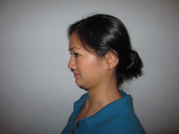 Physical Therapy Exercise - Chin Tuck End