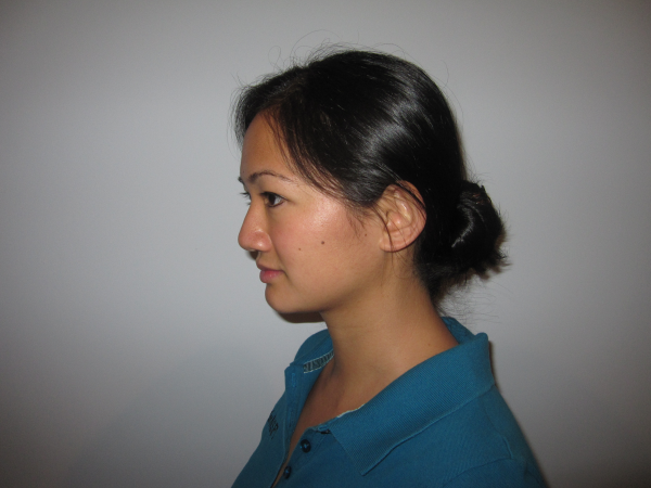 Physical Therapy Exercise - Chin Tuck start
