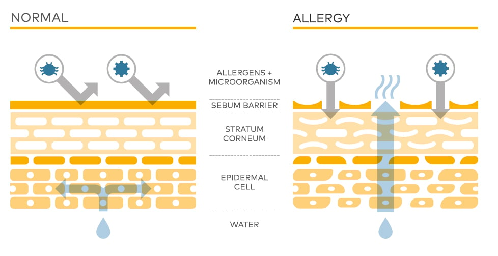 skin-barrier