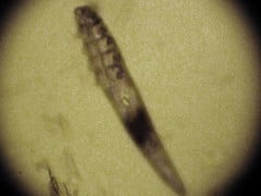 demodex