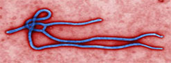 Ebola virus, Photo CDC Cynthia Goldsmith