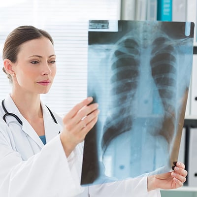 c-r-bard-ivc-filter-trial-verdict