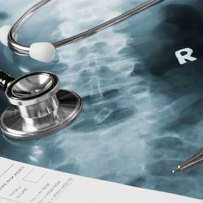 maximum-medical-improvement-jones-act