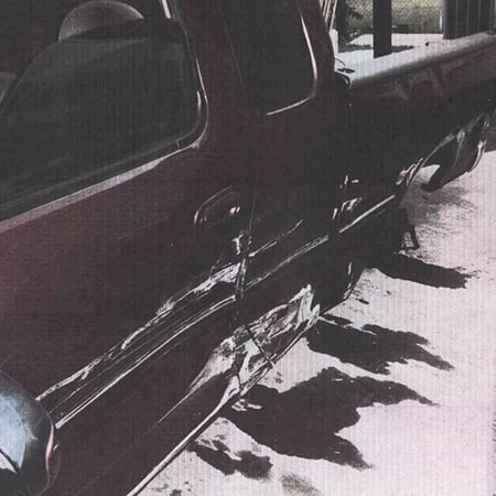 reckless-driving-settle-injury