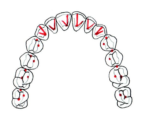 perfected dental occlusion