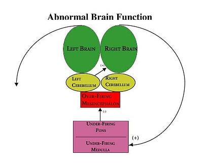 Abnormal Brain Function Schematic BBT