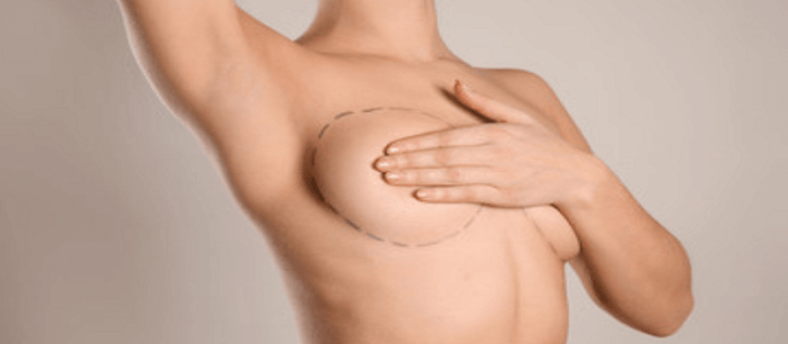 5 Tips for Recovering from Breast Augmentation