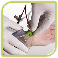 Our latest blog: The Use of Robotics in Left Trandsradial PCI Our latest blog: The Use of Robotics in Left Trandsradial PCI