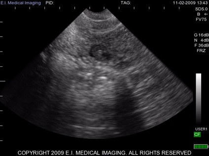 Camelid ultrasound gallery