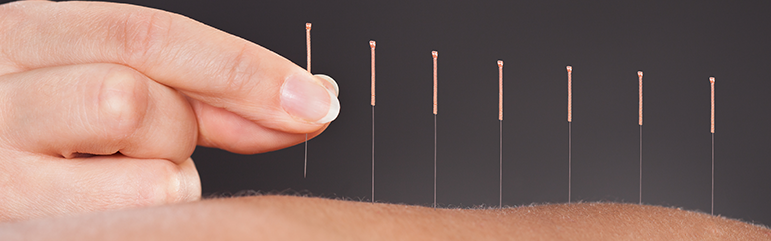 acupuncture-for-COPD-pain-management.png