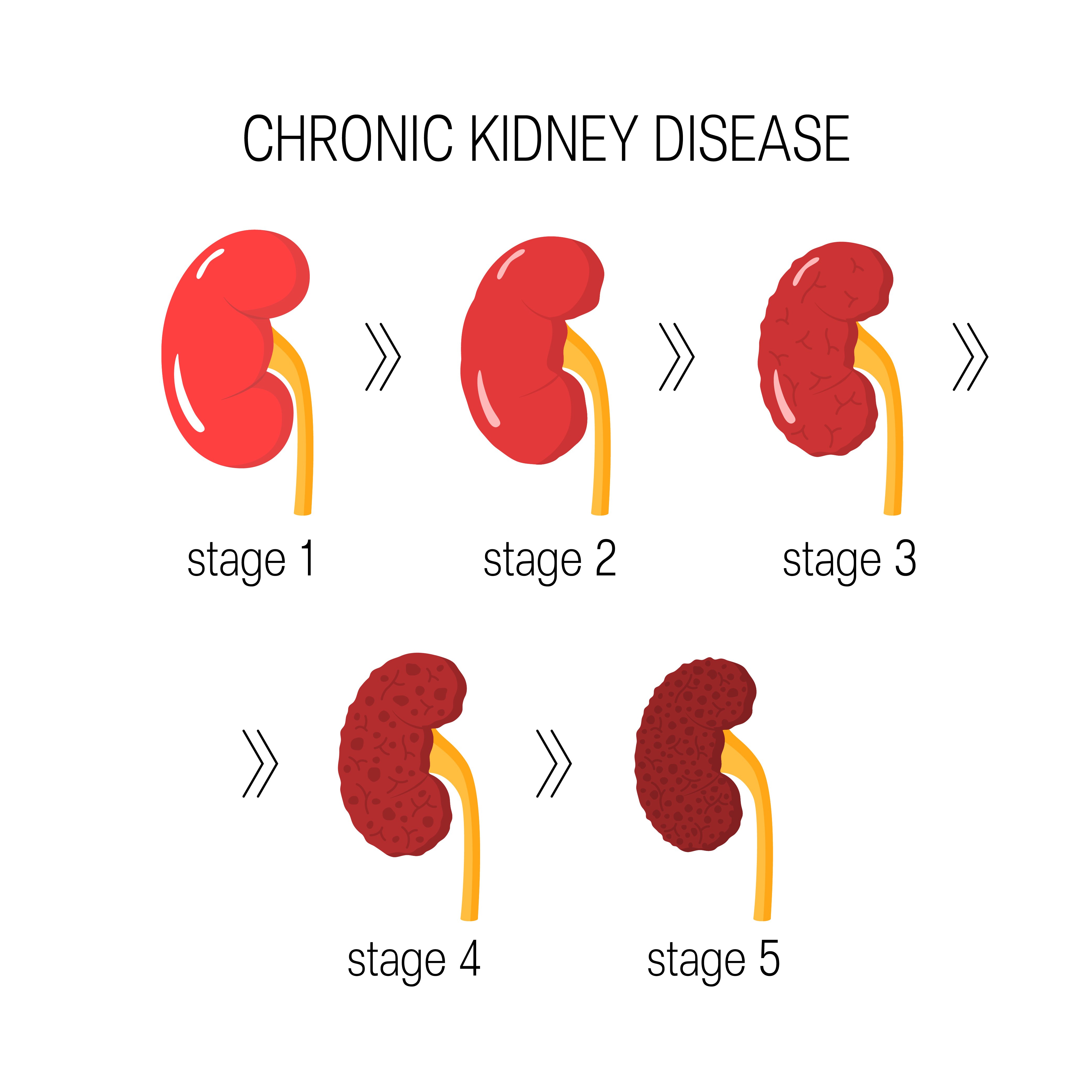 development of kidney disease