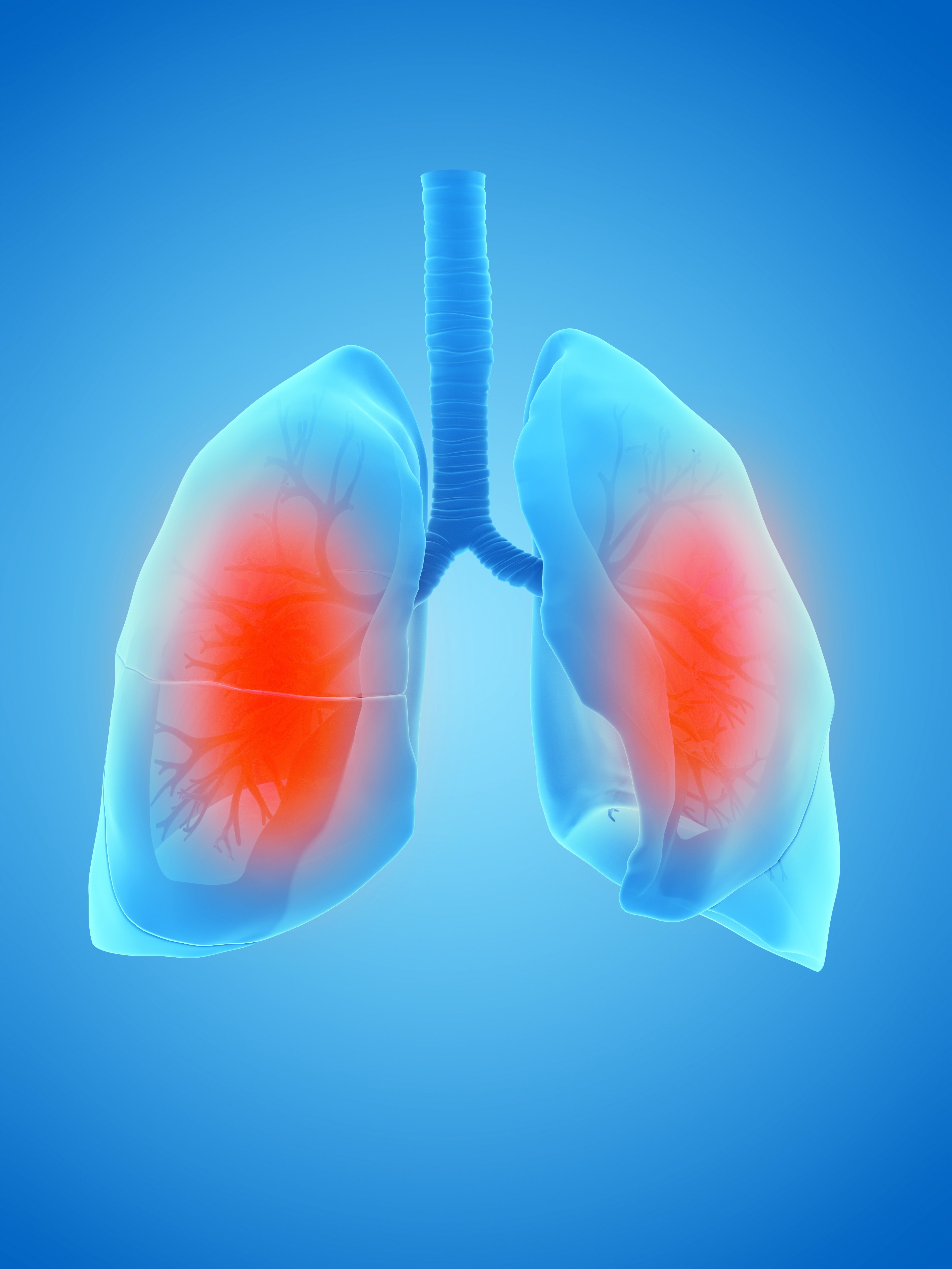 inflammation in the lungs