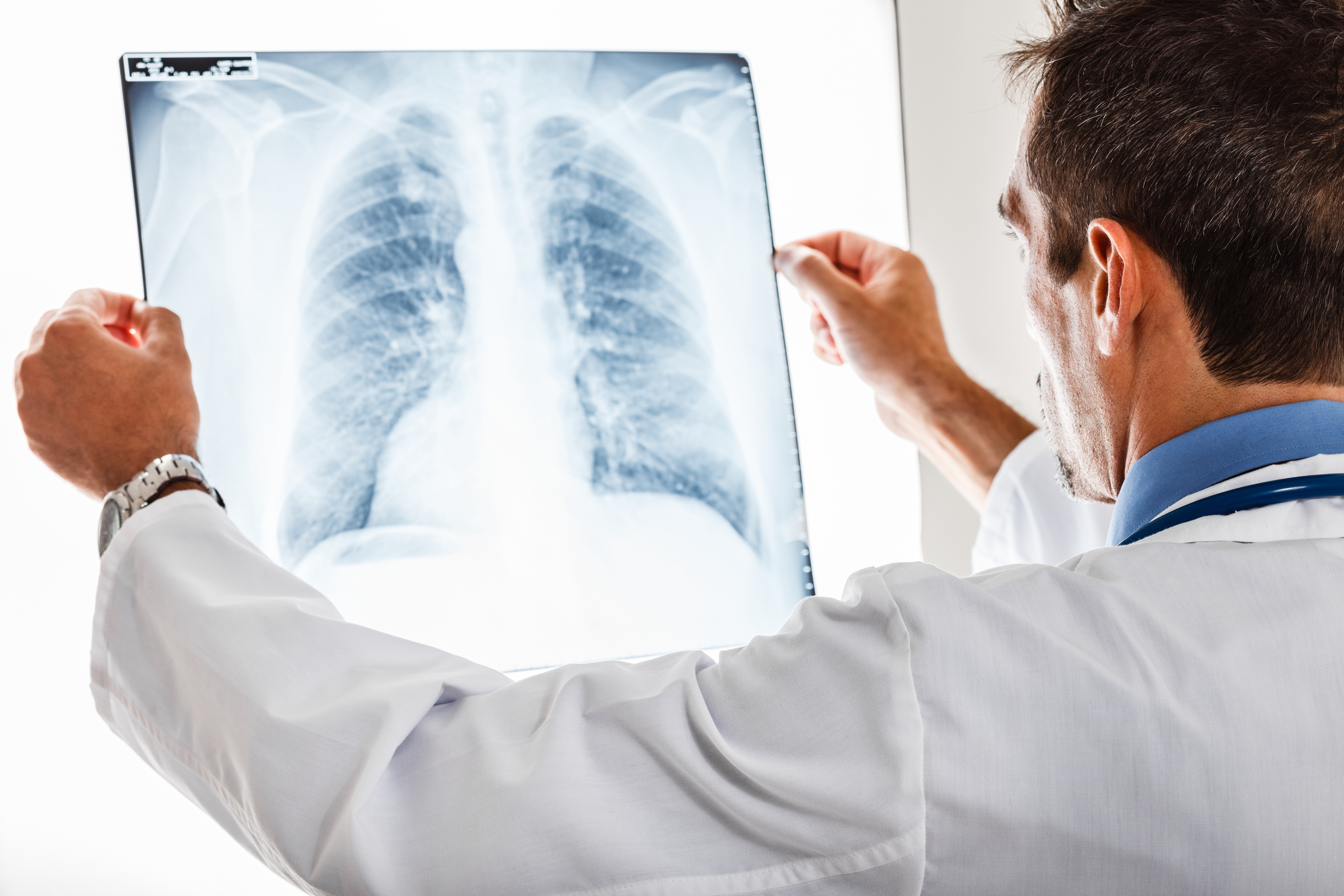 lung xray.jpg