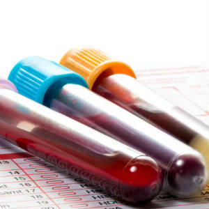 Hepatitis C and Older Adults: Why You Need to Get Tested