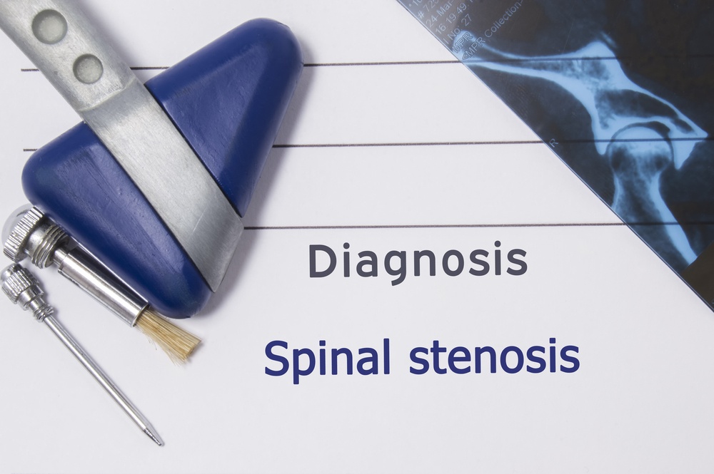Spinal stenosis, diagnosis and treatments