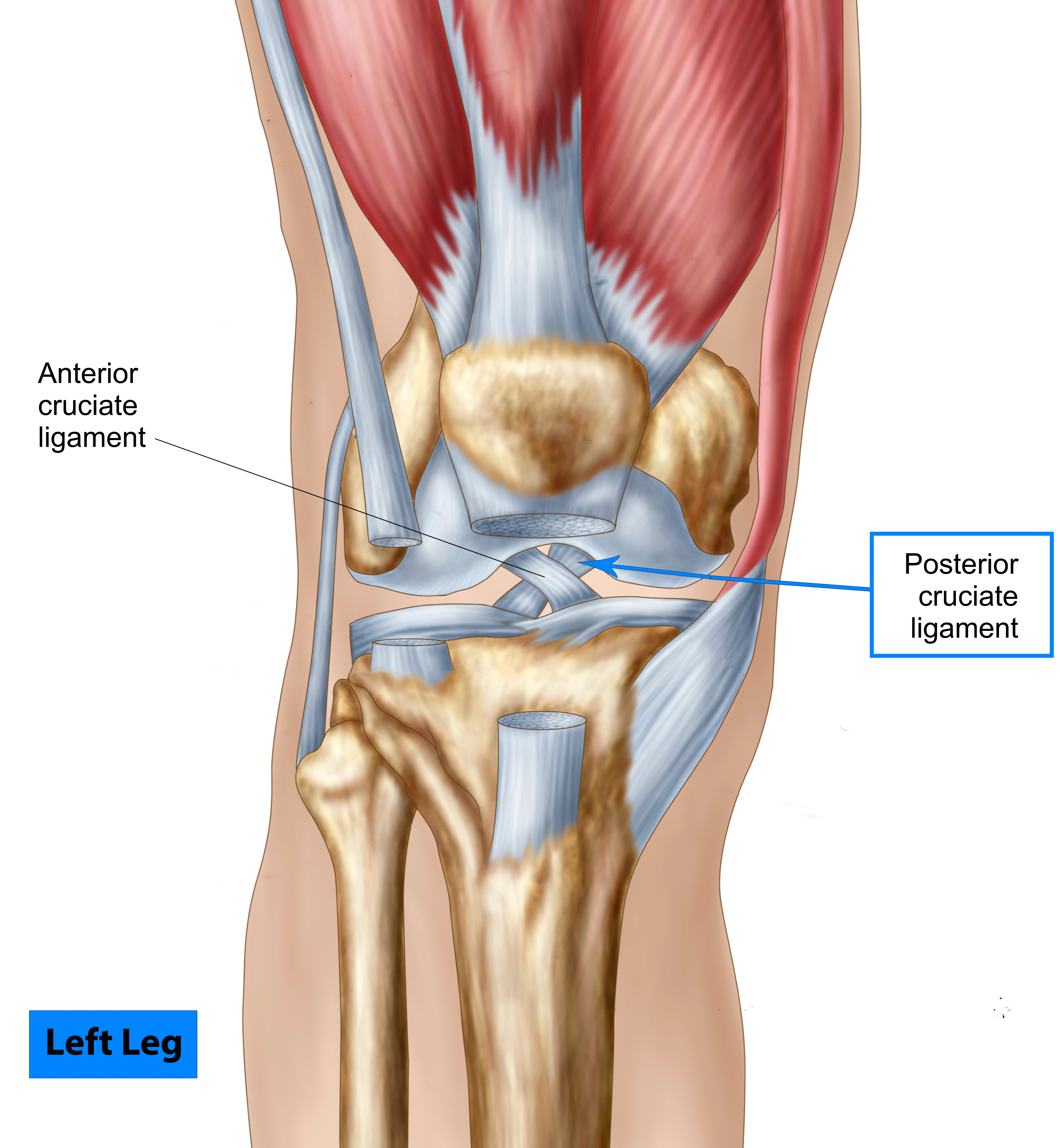 Posterior Cruciate Ligaments Injuries (PCL)