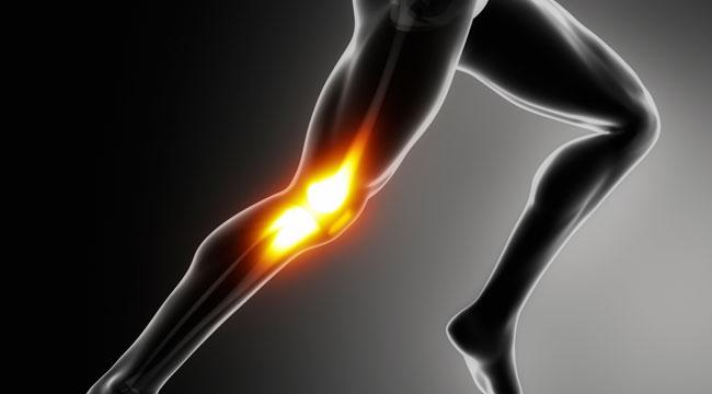 alleviating the common runners knee pain