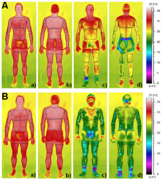 thermal image