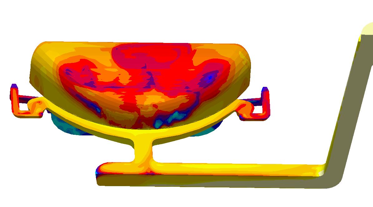 Simulation reduce casting defects