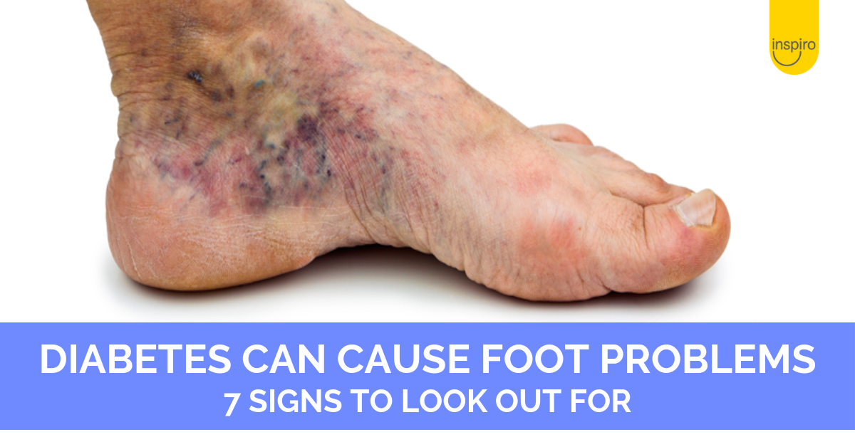 Can Diabetes Cause Pain In Feet - DiabetesWalls