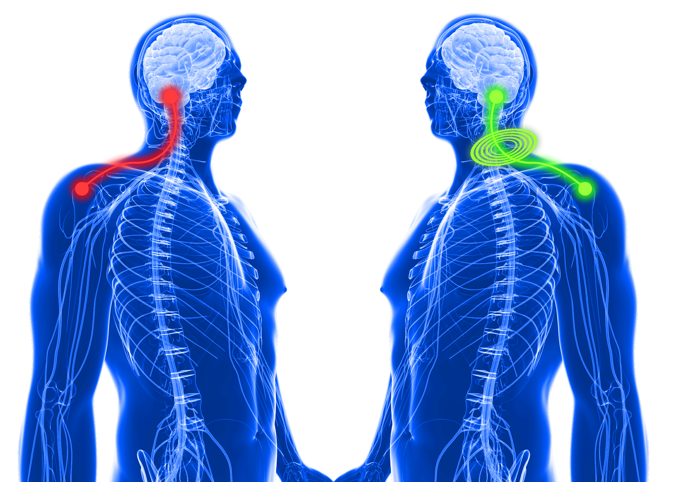 How Tens pain relief works on shoulder pain.png