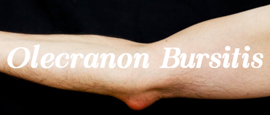 Olecranon Bursitis.png