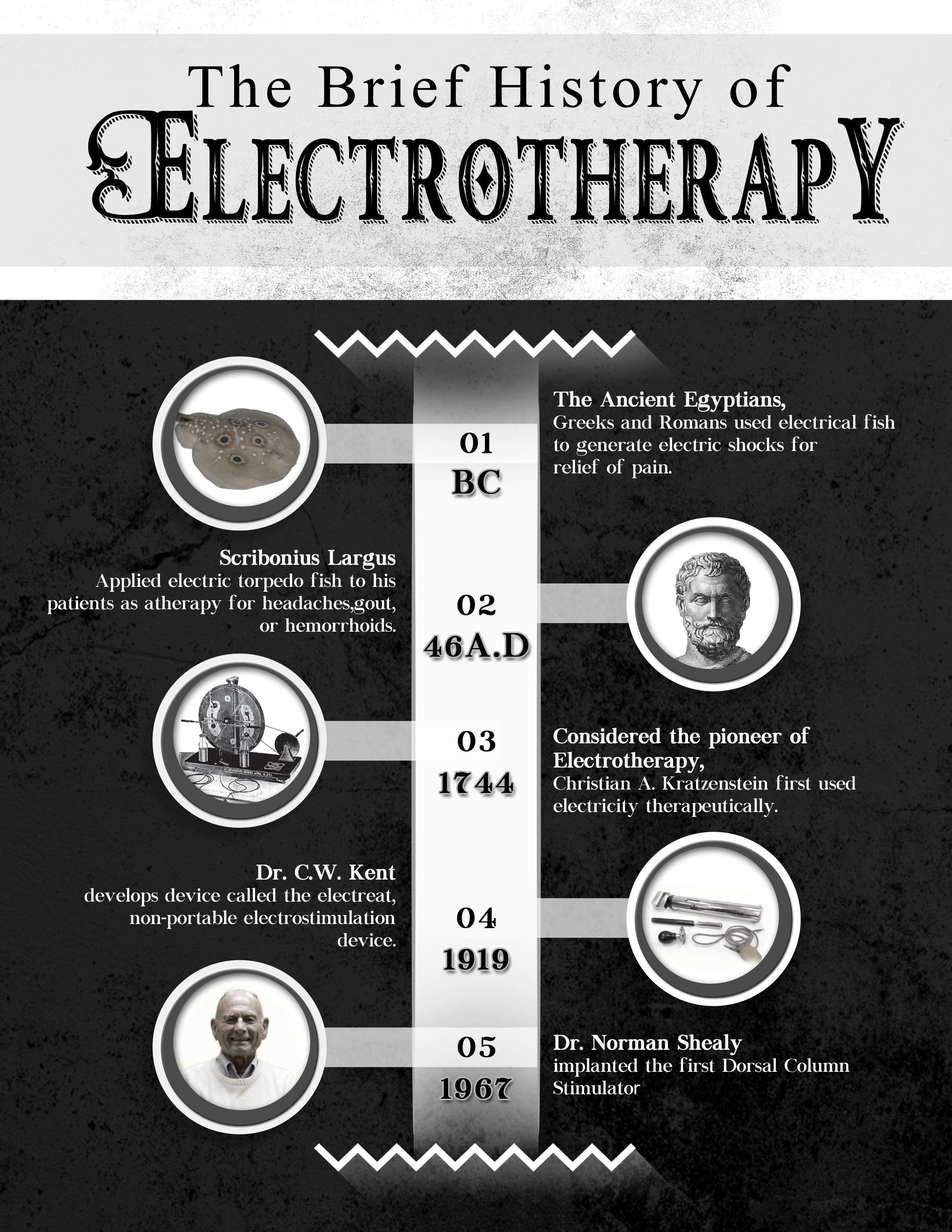 A history of TENS devices and portable pain relief