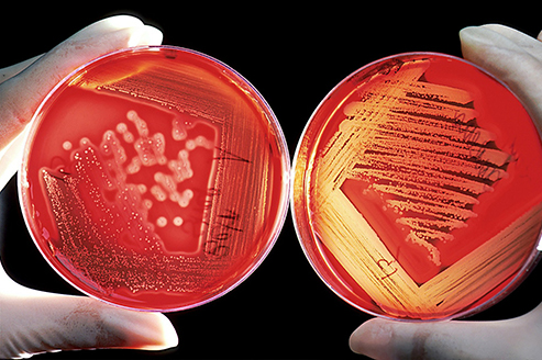 Petri Dish Germ Lab Microbes Bacteria