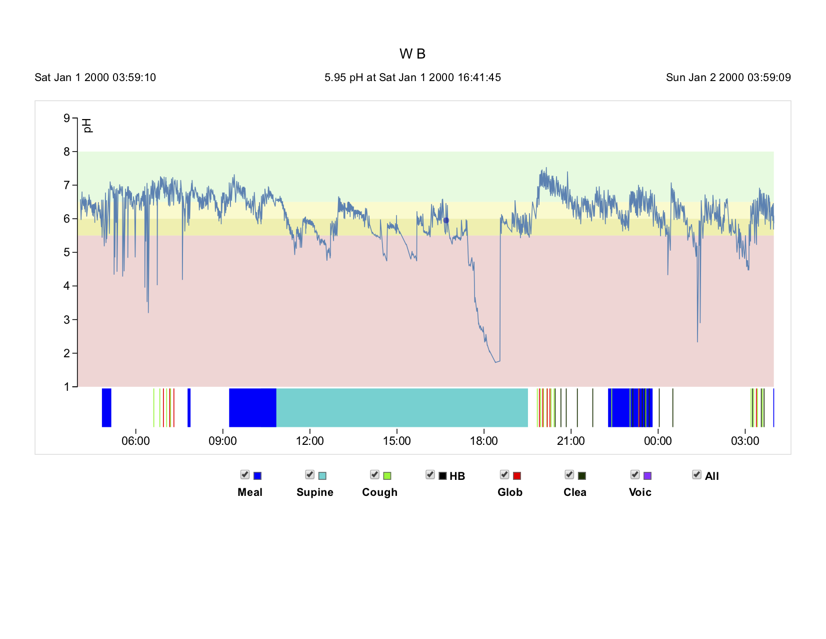 Zalvan Case Study Graph