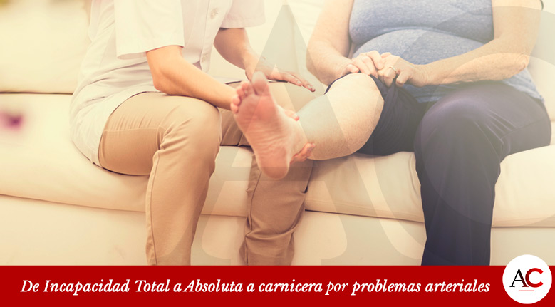 [Featured]-CE84-IPT-a-IPA-por-problemas-arteriales-en-piernas-a-carnicera