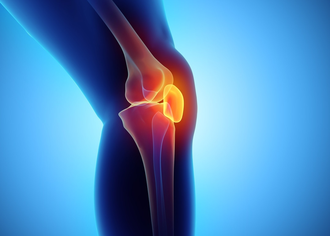 Why does knee dislocation occur and how do you fix it?