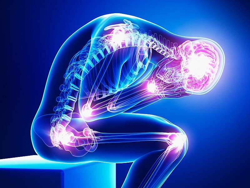 Skeletal Chronic Pain