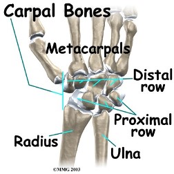 Ulnar-Sided Wrist Pain: Midcarpal Instability