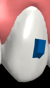 Engager.png Engager.png