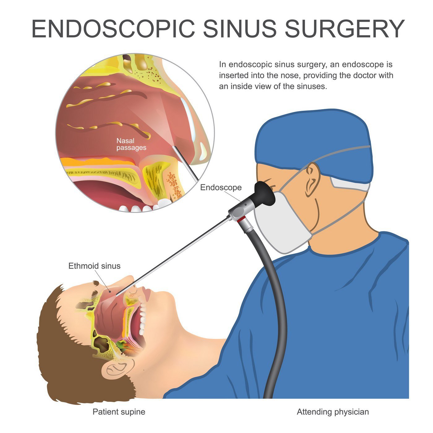 ENT Specialist Singapore  The Cons Of Nose Picking